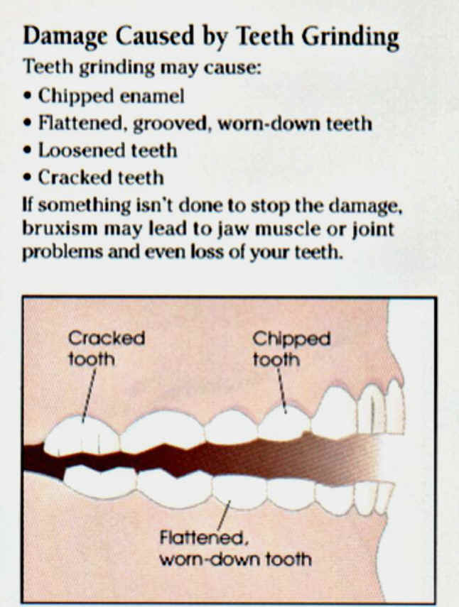 Clenching jaw at night 